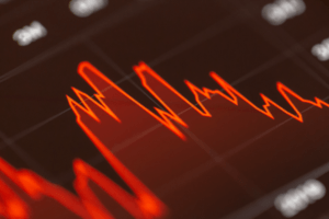 Einbruch beim Bitcoin-Kurs: Drei mögliche Gründe